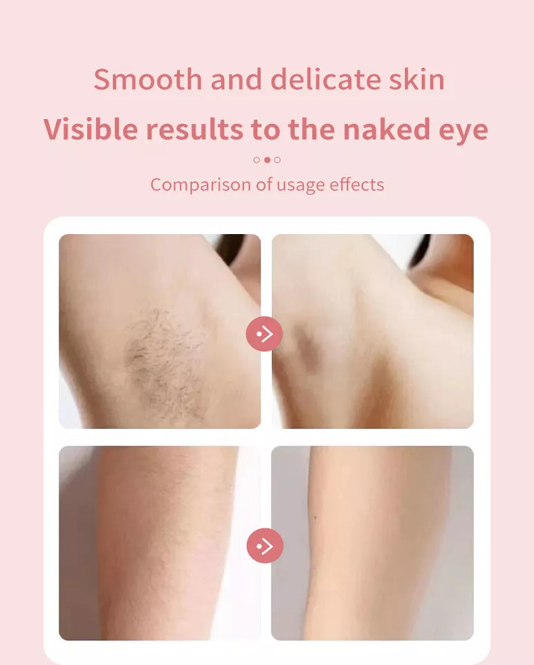 Women Pro Silk Glide Epilator | Electric Shaver Razors | Trimmer Bikini Hair Remover | 5W and 3.7V